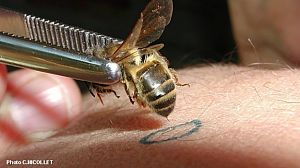 Apipuncture, une branche de l'Apithérapie. Cette technique de soins fait appel au venin d'abeille